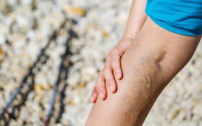 Reducing Joint Pain Through Food