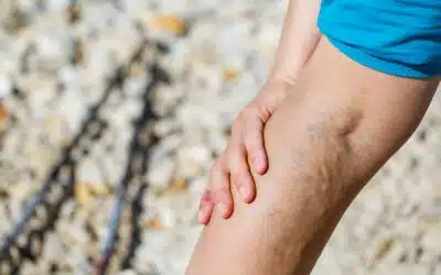 Reducing Joint Pain Through Food